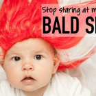 Stop Staring at My Baby's Bald Spot...
