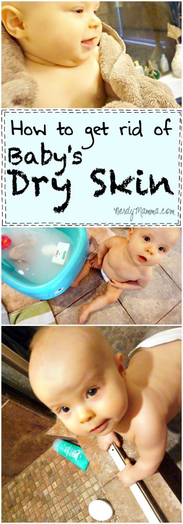 How to Get Rid of Baby's Dry Skin - Nerdy Mamma